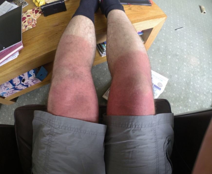 knees.JPG.10deeb771c118d98fff0384b44217b16.JPG