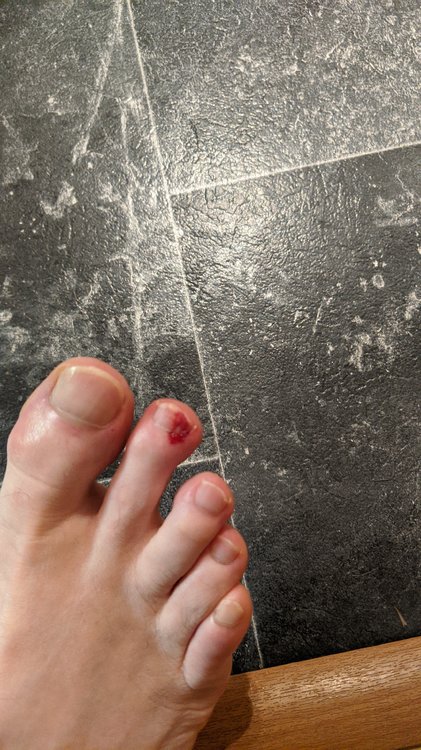 toe.jpg